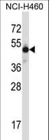 MKX Antibody (aa46-75)