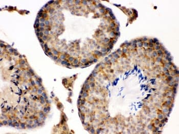 S100A6 / Calcyclin Antibody