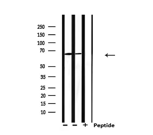 PIAS2 / PIASX Antibody