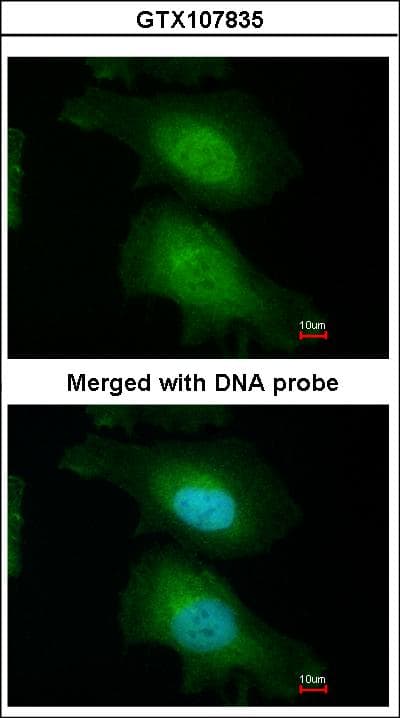 Polyclonal Rabbit anti-Human FASTKD1 Antibody (aa461-847, WB)
