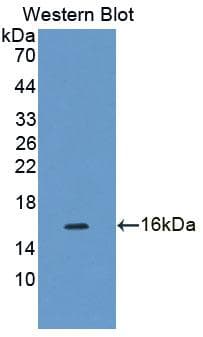 CDK2AP1 / DOC1 Antibody
