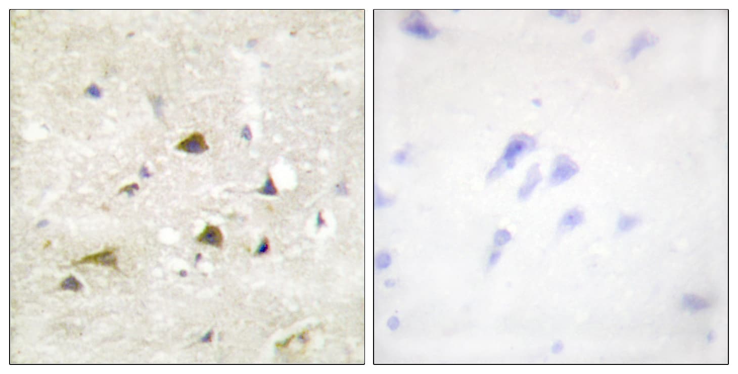 IKBKB / IKK2 / IKK Beta Antibody (aa161-210)