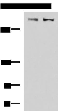 Polyclonal Rabbit anti-Human ABP-280 / FLNC Antibody (IHC, WB)