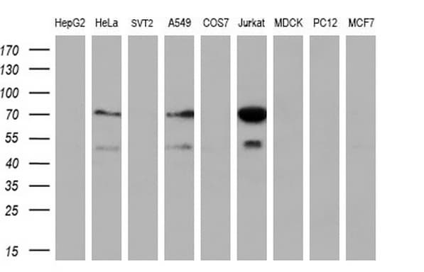 GCKR Antibody (clone OTI1E7)