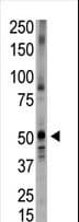 BMP5 Antibody (aa16-46)