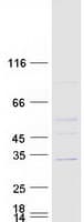 Human ASB7 Protein (Recombinant Myc-DDK (Flag))