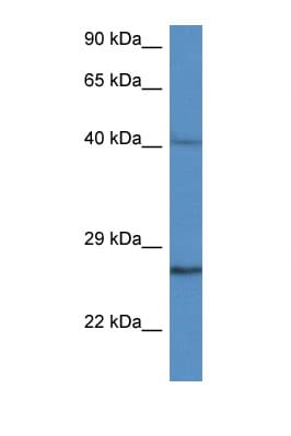 CCS Antibody (C-Terminus)