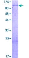 Human KIAA0020 / PEN Protein (Recombinant GST)