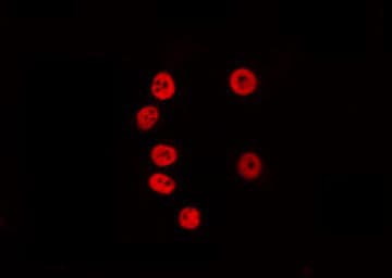 Polyclonal Rabbit anti-Human KLF7 Antibody (IF, WB)