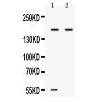 Polyclonal Rabbit anti-Human CP / Ceruloplasmin Antibody (aa20-259, IHC, WB)