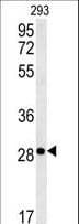 EPCAM Antibody (aa57-85)