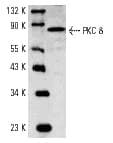 PRKCD / PKC-Delta Antibody (Gly499)