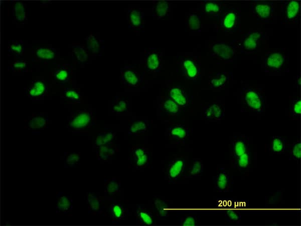 Monoclonal Mouse anti-Human MEIS2 Antibody (clone 1H4, IHC, IF, WB)