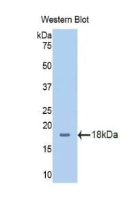 SLC3A2 / CD98 Heavy Chain Antibody (aa213-349)