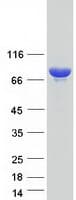 Human GFPT1 / GFAT Protein (Recombinant Myc-DDK (Flag))