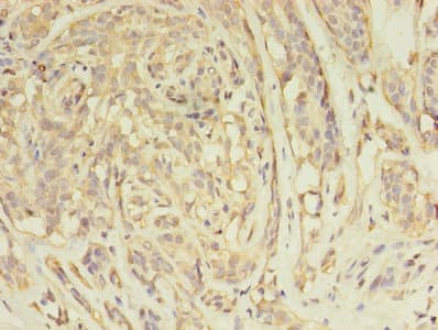 ARFIP2 / Arfaptin 2 Antibody