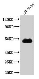 IHC-plus™ Polyclonal Rabbit anti-Human NADK / NAD Kinase Antibody (IHC)