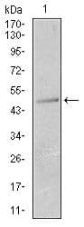 Monoclonal Mouse anti-Human KRT13 / CK13 / Cytokeratin 13 Antibody (clone 3G4, Amino Acid: 143-295, WB)