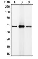 C/EBP Beta / CEBPB Antibody (C-Terminus)