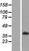 TMEM198 Protein (Over-Expression Lysate Myc-DDK (Flag))