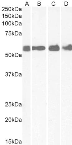 CRFR1 / CRHR1 Antibody (aa107-117)