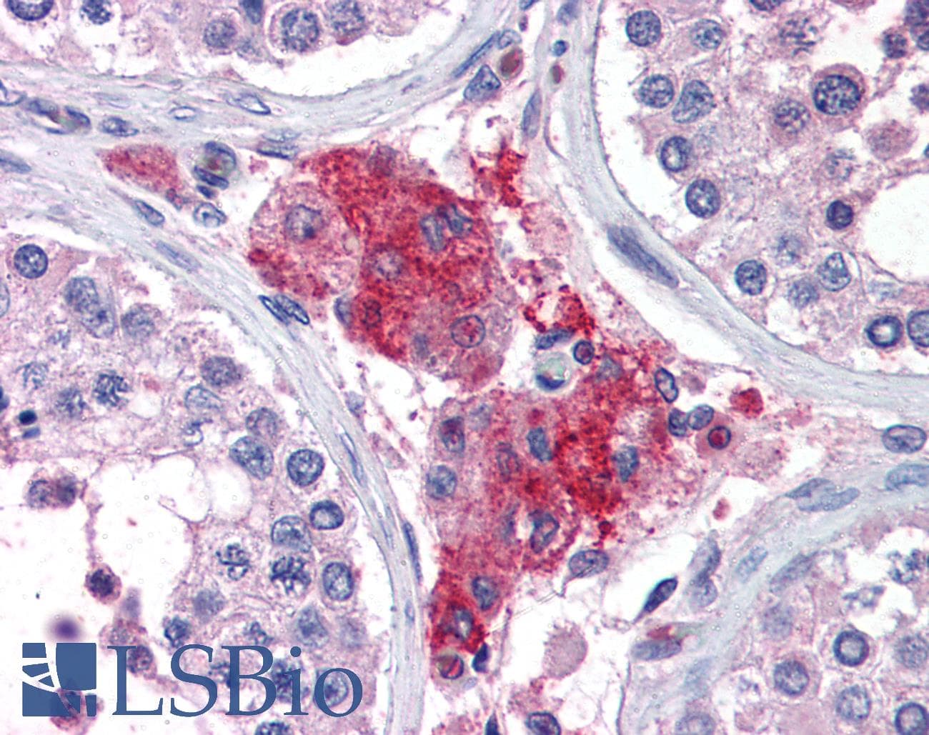 IHC-plus™ ACYP1 Antibody (aa72-85)