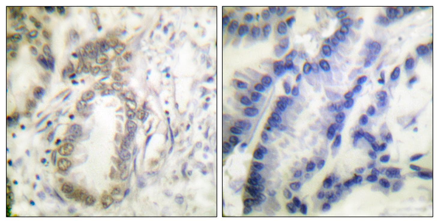 C/EBP Alpha / CEBPA Antibody (phospho-Ser21)
