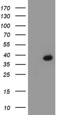 IHC-plus™ CDX2 Antibody (clone 2G5)