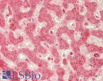 Polyclonal Rabbit anti-Human PKD3 / PRKD3 Antibody (Internal, IHC, WB)