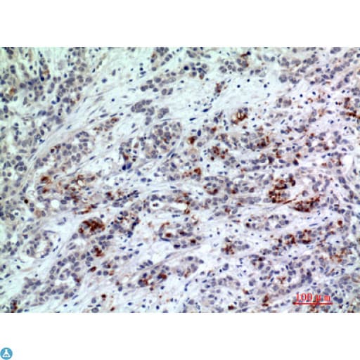 Polyclonal Rabbit anti-Human BATF3 Antibody (IHC, WB)