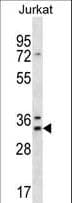 DNAJC9 Antibody (aa29-58)