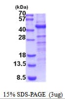 Human CHST10 Protein (Recombinant His)