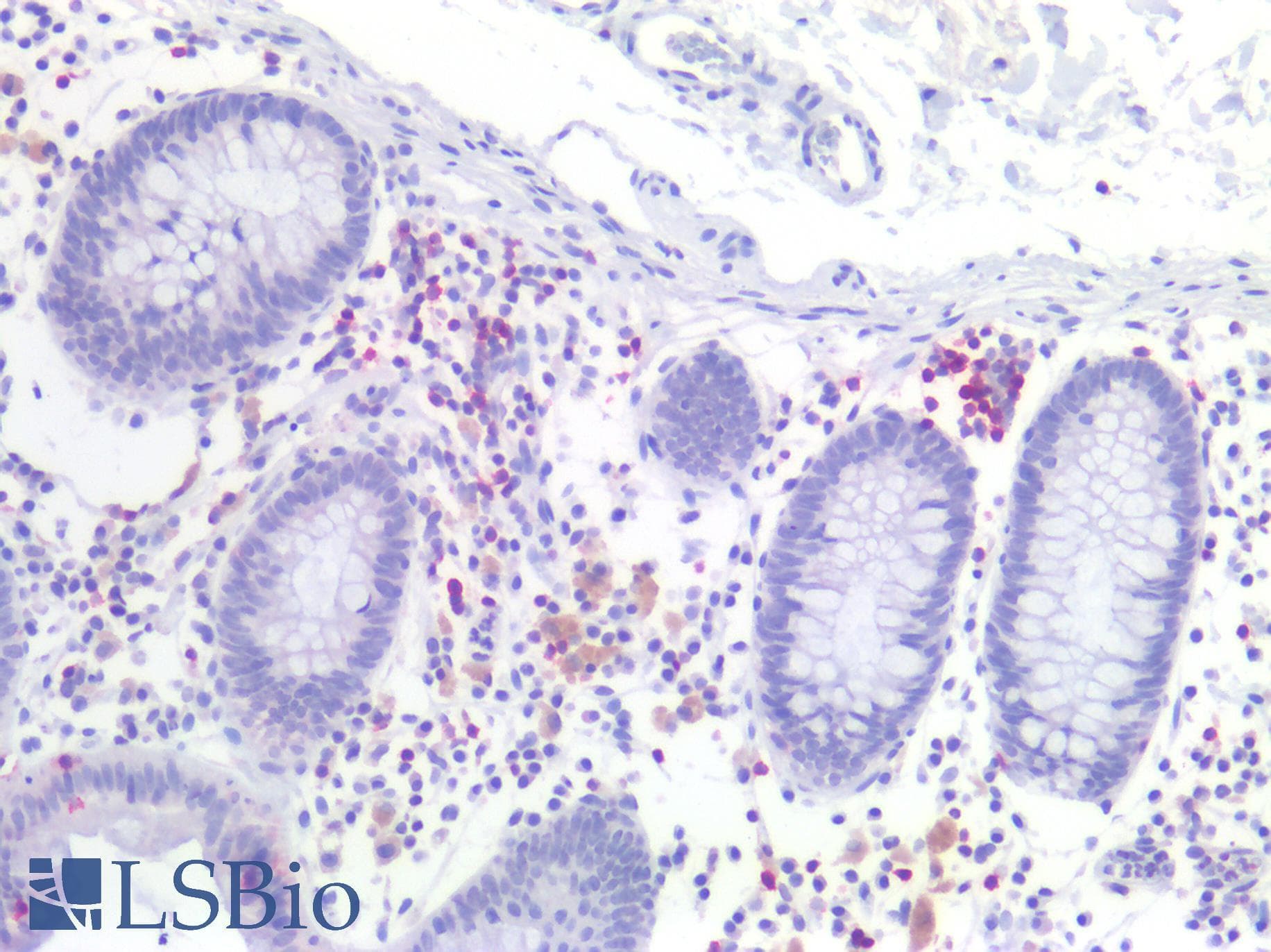 PathPlus™ CD7 Antibody (clone MEM-186)