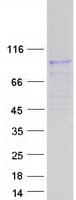 Human ATP6V0A4 Protein (Recombinant Myc-DDK (Flag))
