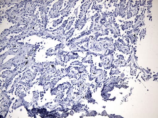Monoclonal Mouse anti-Human EGFR Antibody (clone UMAB234, Carrier-free, IHC)