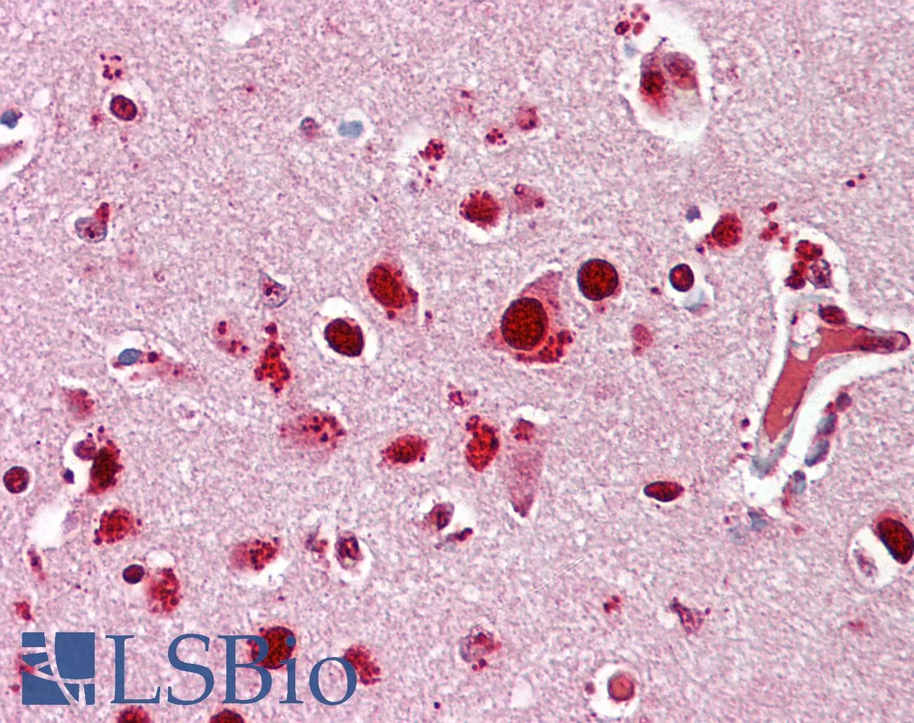 IHC-plus™ Polyclonal Rabbit anti-Human MAPK14 / p38 Antibody (IHC, WB)