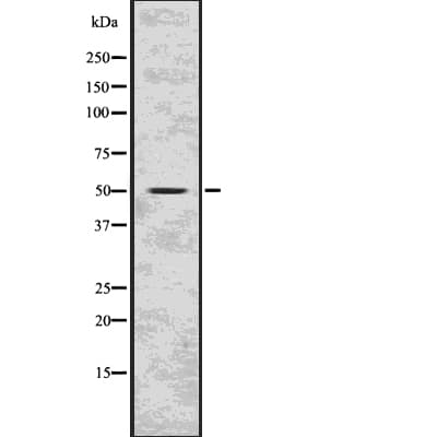 Polyclonal Rabbit anti-Human MAP2K5 / MEK5 Antibody (WB)