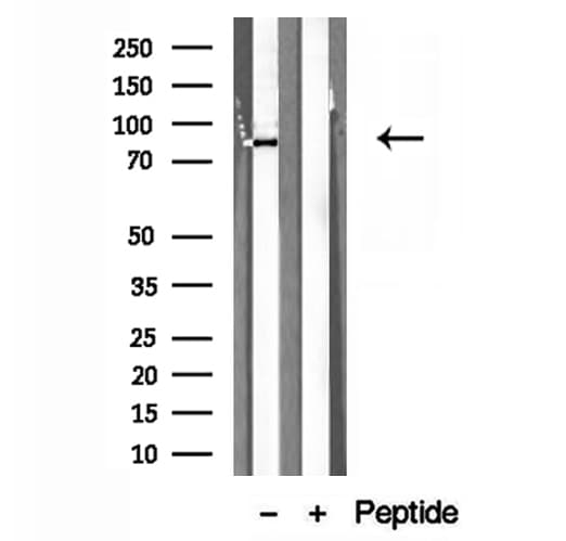 PDIA4 / ERP72 Antibody