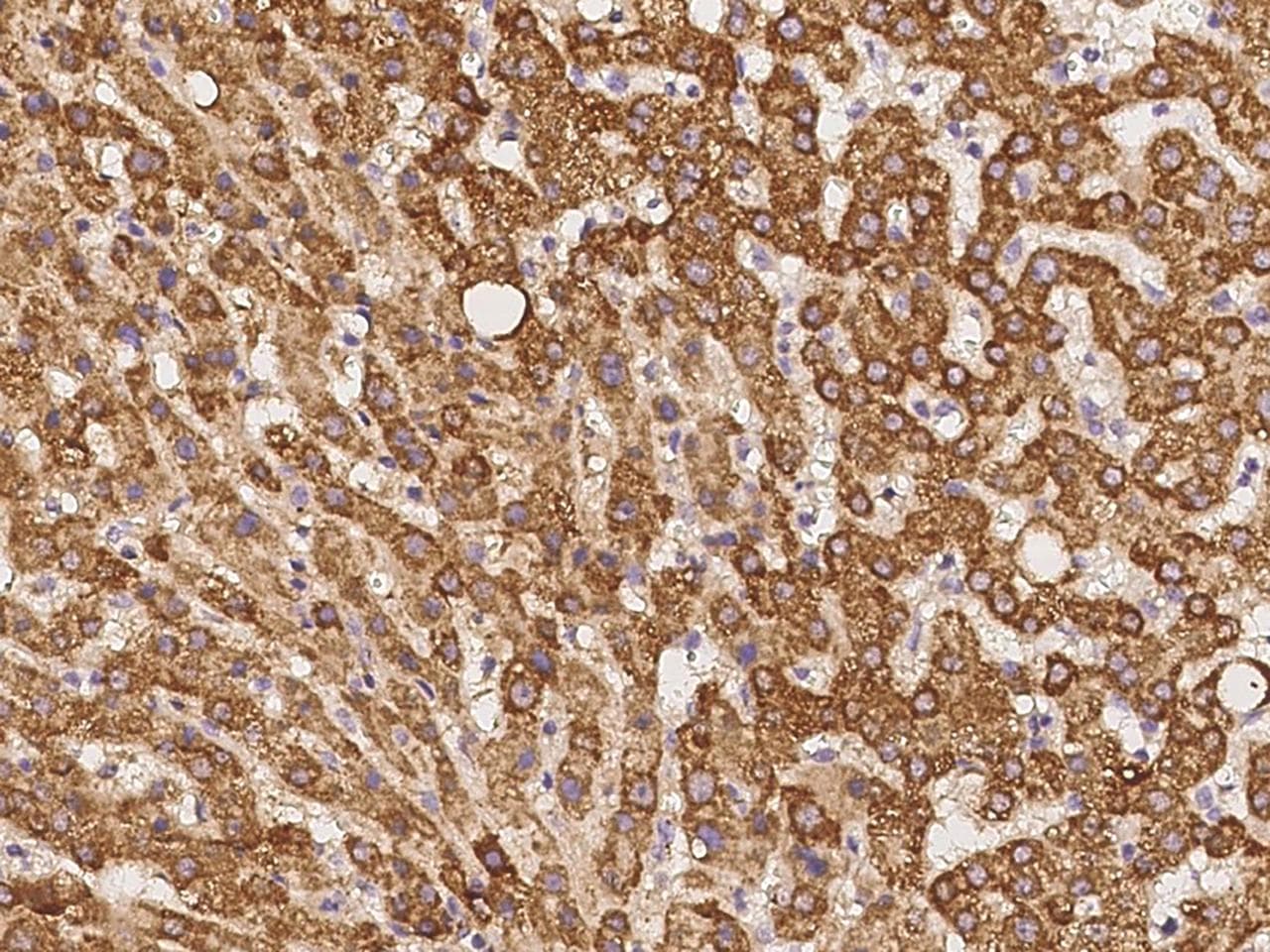 TIMM8A Antibody
