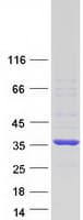 Human MNAT1 Protein (Recombinant Myc-DDK (Flag))