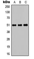 POTEA / POTE8 Antibody (C-Terminus)