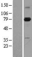 ASH2L / ASH2 Protein (Over-Expression Lysate Myc-DDK (Flag))