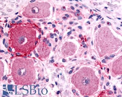 IHC-plus™ HTR1D / 5-HT1D Receptor Antibody (Extracellular Domain)