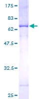 Human MTCH1 Protein (Recombinant GST)