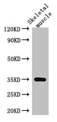 Polyclonal Rabbit anti-Human ANKRD23 / DARP Antibody
