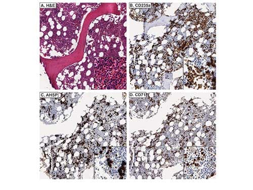 AHSP / EDRF Antibody (Liquid)