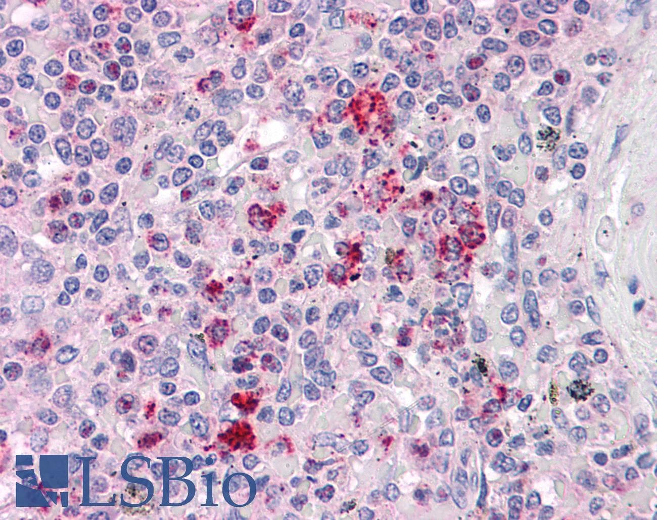 IHC-plus™ CCT2 / CCT Beta Antibody