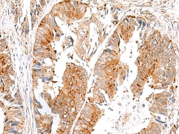 SAXO2 / FAM154B Antibody