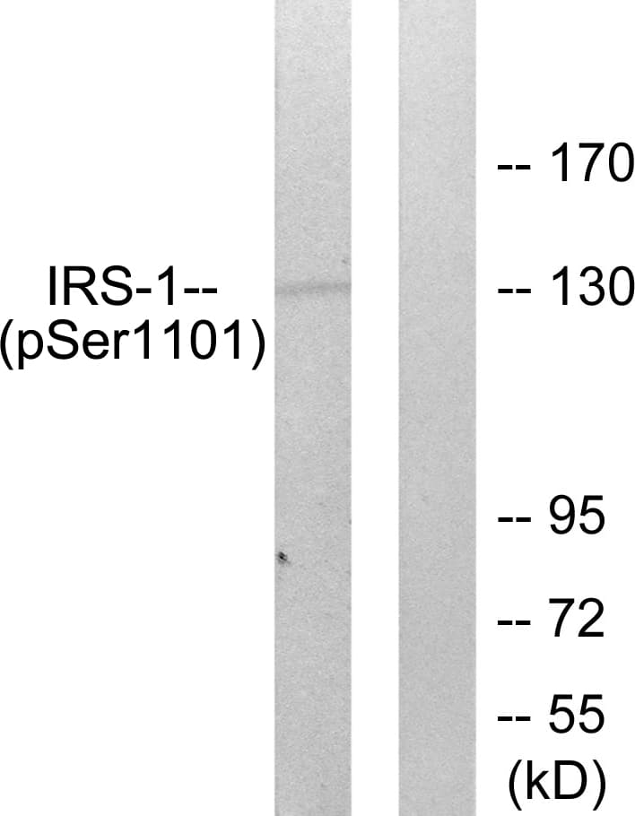 IRS1 Antibody (phospho-Ser1101)