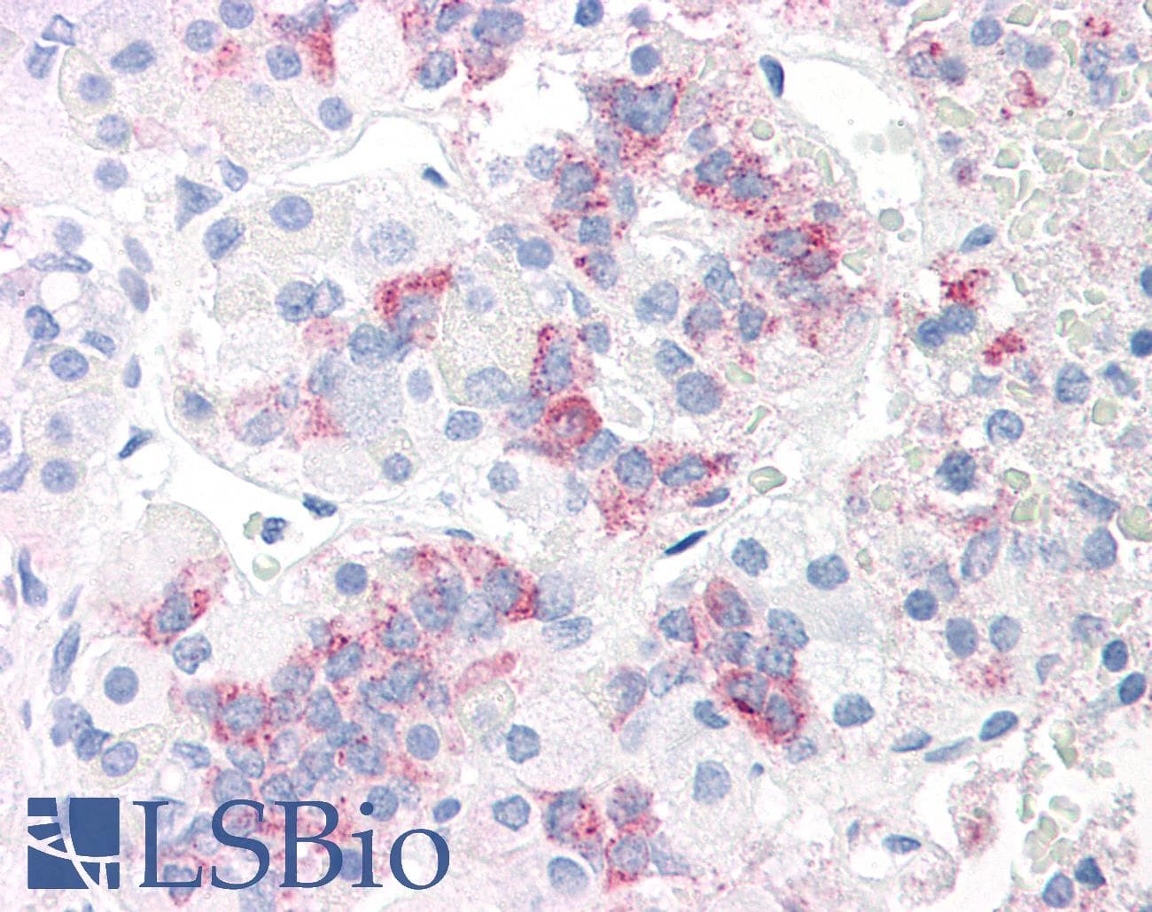 PathPlus™ Monoclonal Mouse anti-Human PRL / Prolactin Antibody (IHC)